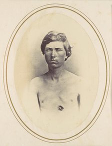 Frederick A. Bentley, 1865. Creator: Reed Brockway Bontecou.