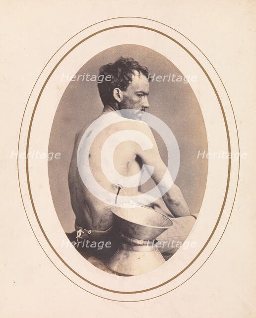 Corporal Israel Spotts, Company G, 200th Pennsylvania Volunteers, April-May 1865. Creator: Reed Brockway Bontecou.