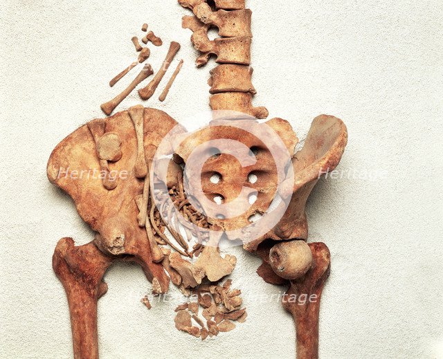 The pelvis of a young Medieval woman. Artist: Unknown