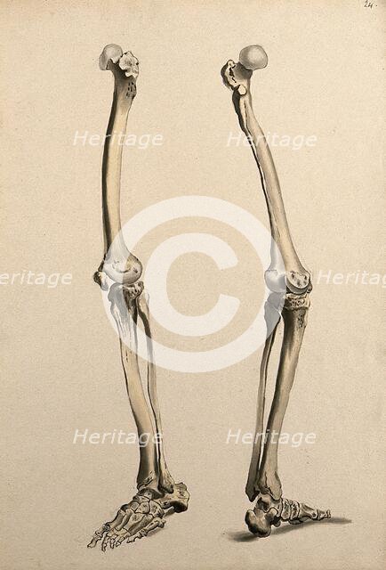 Bones of the leg and foot, 1830-1835. Creator: Unknown.