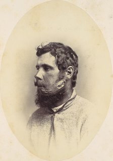 Andrew Wagoner, 1865. Creator: Reed Brockway Bontecou.