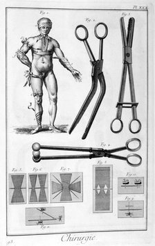 Surgery, 1751-1777. Artist: Unknown