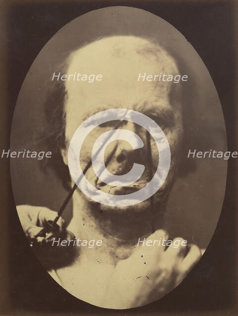 Figure 18: Aggression, wickedness, 1854-56, printed 1862. Creators: Duchenne de Boulogne, Adrien Alban Tournachon.