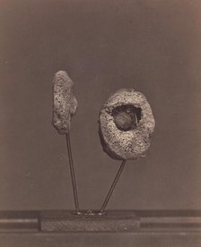 Excised Knee Joint. A Round Musket Ball in the Inner Condyle of the Right Femur [Gardin..., 1866-67. Creator: William H. Bell.