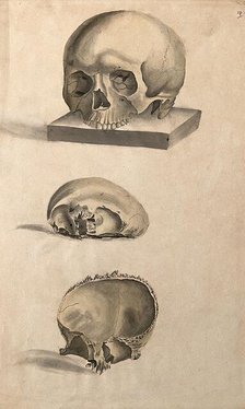 Human skull: three figures showing sections and an entire skull, 1830-1835. Creator: Unknown.