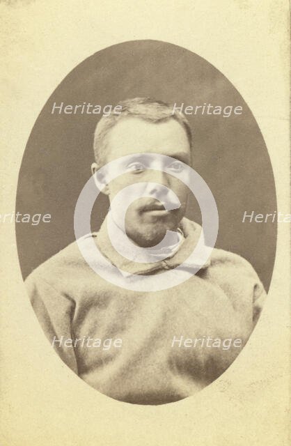 Head-and-shoulders portrait of a man, dressed in convict clothing, facing..., between 1880 and 1886. Creator: Unknown.