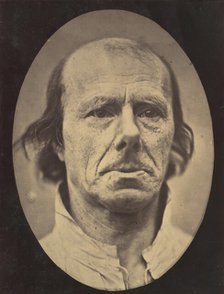 Figure 3: The face of an old man... photographed in repose., 1854-56, printed 1862. Creators: Duchenne de Boulogne, Adrien Alban Tournachon.