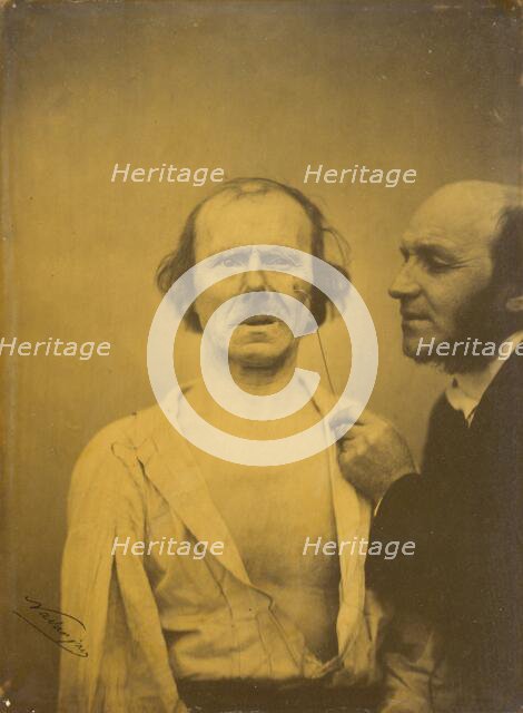 Weeping, tears of pity (left); Relaxed face (right), 1854-1856, printed 1862. Creator: Duchenne de Boulogne.