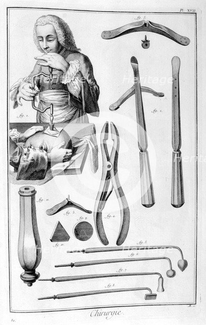 Head surgery, 1751-1777. Artist: Unknown