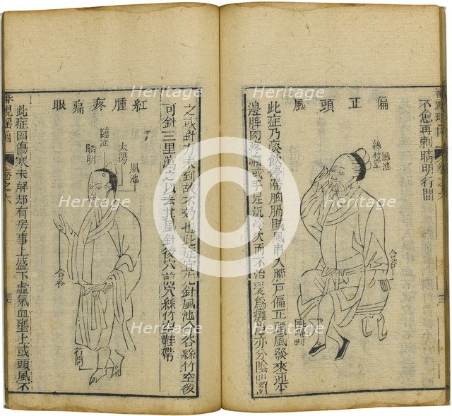 Shen Shi Yao Han (A Precious Book of Ophthalmology), 1644. Artist: Fu Renyu (active Mid of 17th cen.)