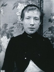 Gloucester smallpox epidemic, 1896: Ethel Cromwell, aged about 14 years, as a smallpox patient, 1896 Creator: HCF of Gloucester.