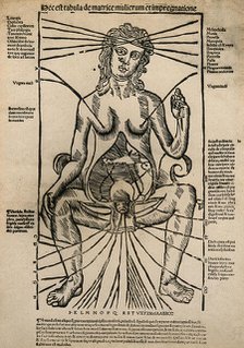 A seated female figure with a dissected abdomen, c1525-1530 (woodcut). Creator: Unknown.