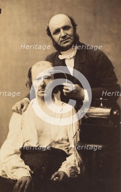 Faradisation du muscle frontal, 1854-56, printed 1862. Creators: Duchenne de Boulogne, Adrien Alban Tournachon.