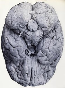 Friern Hospital, London: a brain, 1890-1910. Creator: Unknown.