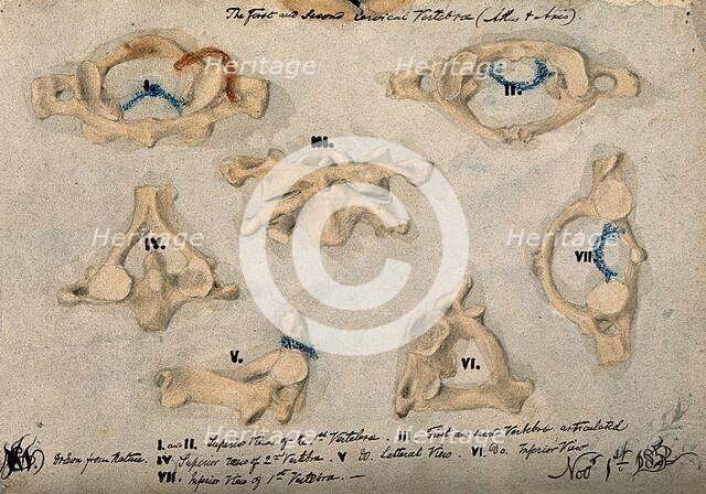 The first and second cervical vertebrae, 1852/11/09. Creator: J.C. Whishaw.