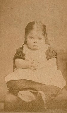 A very young girl, showing signs of mental deficiency, seated with her hands clasped upon her lap. Creator: William Moscrop.