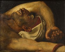 Head of Dead Arab, c. 1810. Creator: Girodet de Roucy Trioson, Anne Louis (1767-1824).