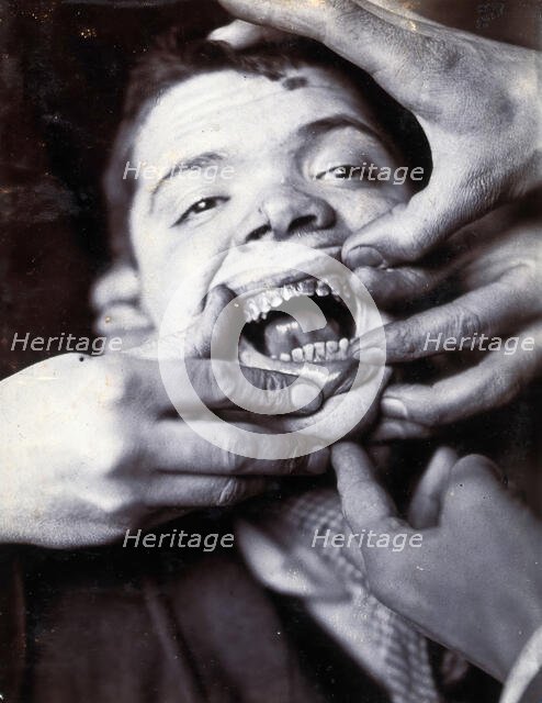 Friern Hospital, London: a boy with rotten teeth, 1890/1910. Creator: Unknown.