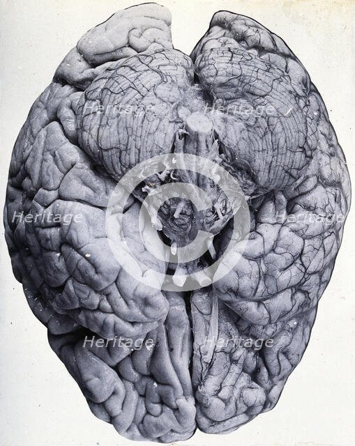 Friern Hospital, London: a brain, 1890/1910. Creator: Unknown.