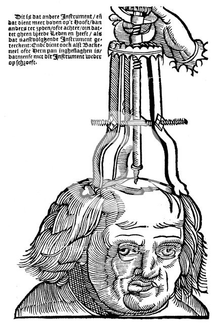 Trephination, 1593. Artist: Unknown
