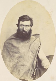 Herman Rice, 1865. Creator: Reed Brockway Bontecou.