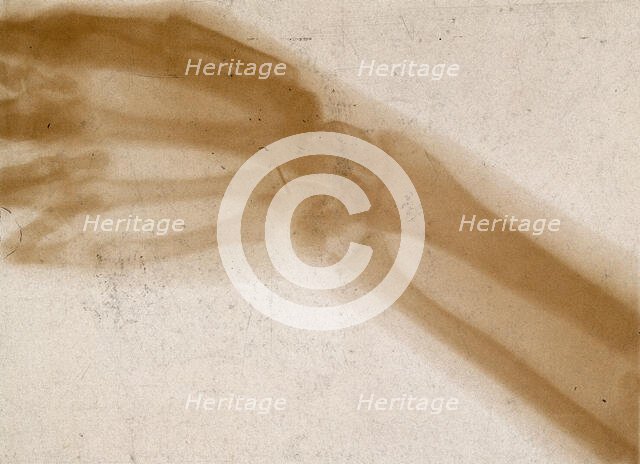The bones of a hand and wrist, viewed through x-ray, 1896.