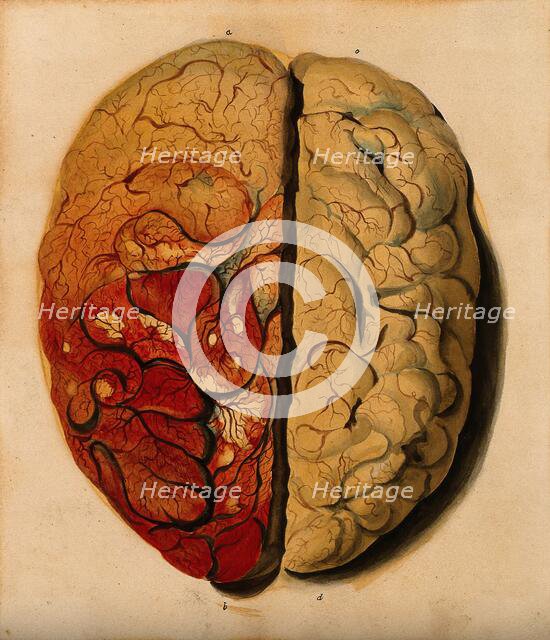 Brain: view from above, showing the gyri, with one hemisphere covered with pia mater, 1820-1827. Creator: Unknown.