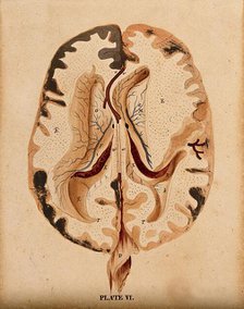 Brain: horizontal section showing lateral ventricles, 1820-1827. Creator: William Home Lizars.