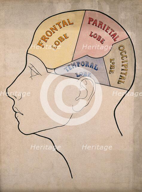 Head of "a backward boy" divided into four cerebral lobes: profile, c1900. Creator: Bernard Hollander.