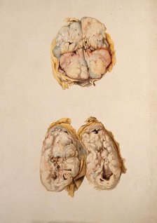 Two diseased parts of the body. Creator: Unknown.