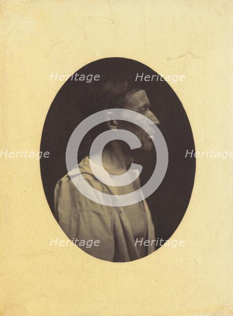 A portrait, seen in profile, of a man 42 years old, stupefied by the abuse of alcohol..., 1854-1856. Creator: Duchenne de Boulogne.