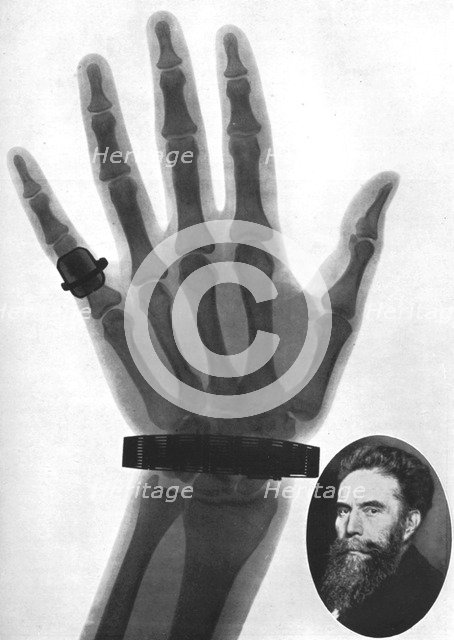 X-ray photograph of a hand, 1926. Artist: Unknown