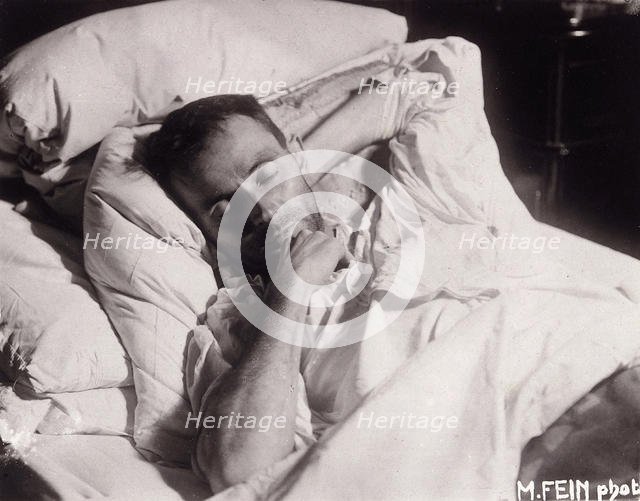 Egon Schiele on his Deathbed, 1918. Creator: Fein, Martha (active ca 1918).