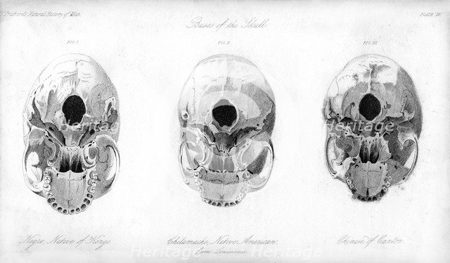 Base of the skull, 1848. Artist: Unknown
