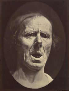 Figure 54: Voluntary lowering of the lower jaw, 1854-56, printed 1862. Creators: Duchenne de Boulogne, Adrien Alban Tournachon.