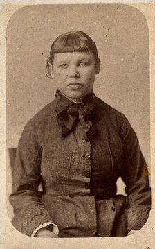 A young woman with a short fringe, showing signs of mental deficiency, c1860s. Creator: John Davis.