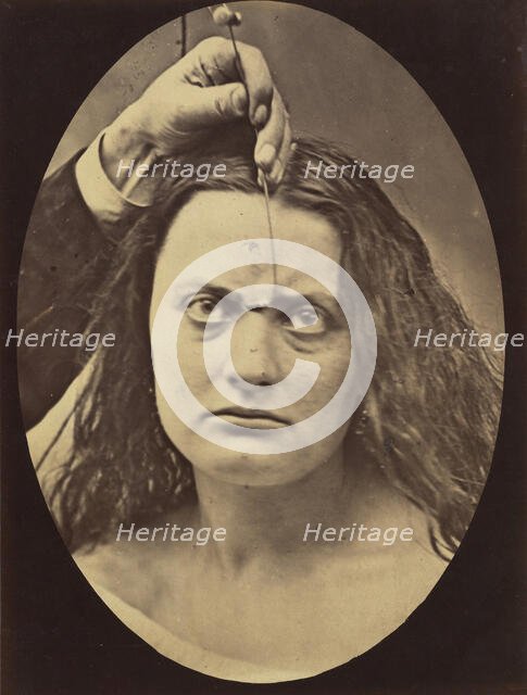 Figure 82: Lady Macbeth, strong expression of cruelty , 1854-56, printed 1862. Creators: Duchenne de Boulogne, Adrien Alban Tournachon.