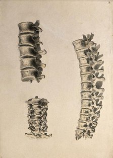 Vertebrae: three figures, 1830-1835. Creator: Unknown.