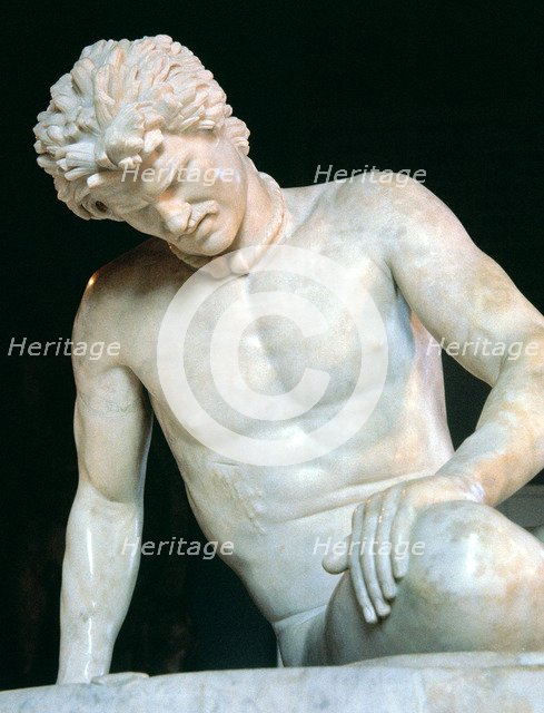 The Galata, a Roman copy of a Greek original of the 3rd - 2nd century BC, detail.