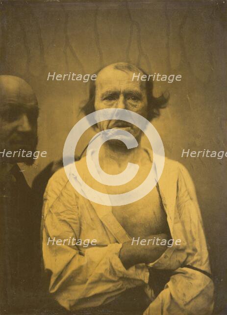 A relaxed expression (left); Disgust (right), 1854-1856, printed 1862. Creator: Duchenne de Boulogne.