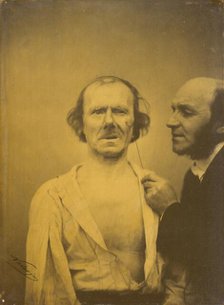 Weeping, tears of pity (left); Relaxed face (right), 1854-1856, printed 1862. Creator: Duchenne de Boulogne.