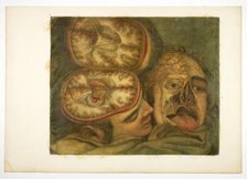Cranial Dissection, plate five from Anatomy of the Head, in Printed Paintings, 1748. Creator: Jacques Fabian Gautier Dagoty.