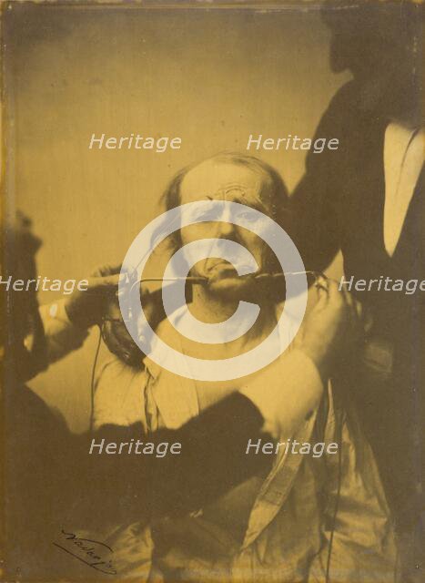 Pain and despair, 1854-1856, printed 1862. Creator: Duchenne de Boulogne.