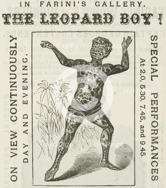 The Leopard Boy! in Farini's Gallery, 1881. Creator: Unknown.