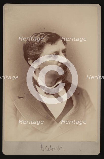 Portrait of Edward Selmar Siebert (1856-1944), 1879. Creator: Samuel Montague Fassett.