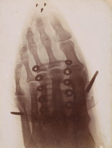Le pied à travers la chaussure, 1896. Creator: Henri van Heurck.