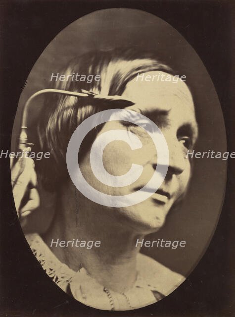 Figure 27: Expression proportionally more pained, 1854-56, printed 1862. Creators: Duchenne de Boulogne, Adrien Alban Tournachon.