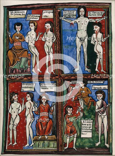 Four vignettes demonstrating different cauterisation points on naked human bodies. Creator: Unknown.