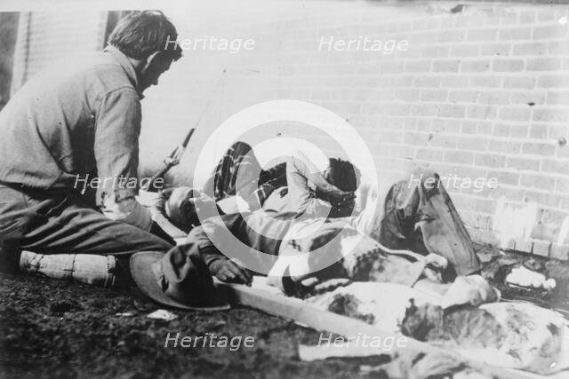 Wounded at Juarez, between c1910 and c1915. Creator: Bain News Service.