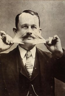 James Morris, stretching the skin on his face. Creator: Unknown.